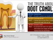 Root Canal Dentist Chicago