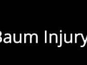 Best Injury Lawyers Temecula