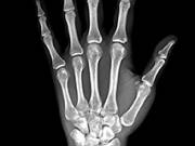Get relief from all hand and wrist problems in Texas
