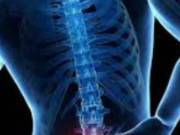 Consult a Specialist for Spondylosis Treatment in Plano, Tx