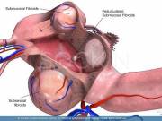Seckin Endometriosis Center
