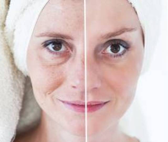 A Powerful Way To Reverse Wrinkles And Fine Lines….Quickly and Easily