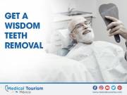 Get a wisdom teeth removal in Chihuahua
