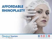 Affordable rhinoplasty in Ensenada