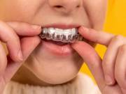 InvisAlign straightens your teeth without wires or braces.