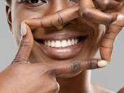 Veneers can help you improve the beauty of your smile.