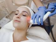 Best Laser Skin Resurfacing Treatment in Chapel Hill, NC