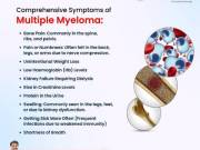 Multiple Myeloma – Advanced Treatment by Dr. S K Guptha